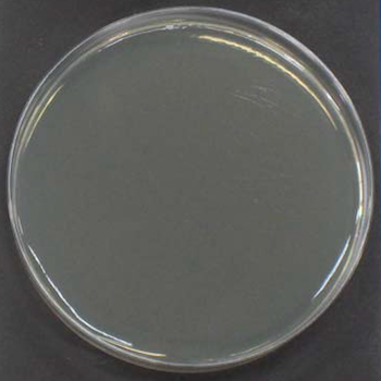 KLEBSIELLA PNEUMONIAE (After)