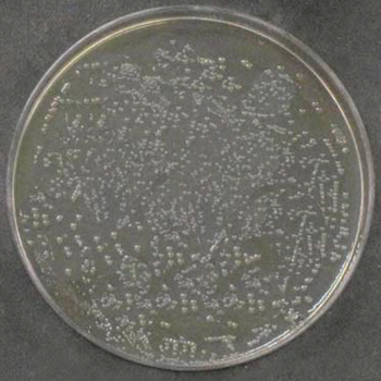 KLEBSIELLA PNEUMONIAE